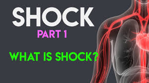 WHAT IS PHYSIOLOGICAL CAUSES OF SHOCK?